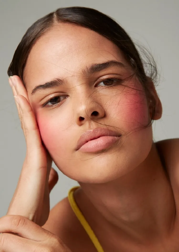 ¿Por qué evitar el maquillaje en una cara quemada por el sol?